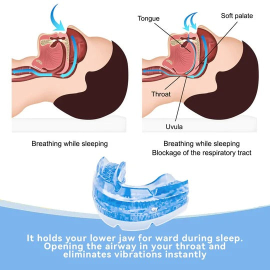 New adjustable anti-snoring mouth guard, BPA-free & reusable. Effective sleep aid for men & women.