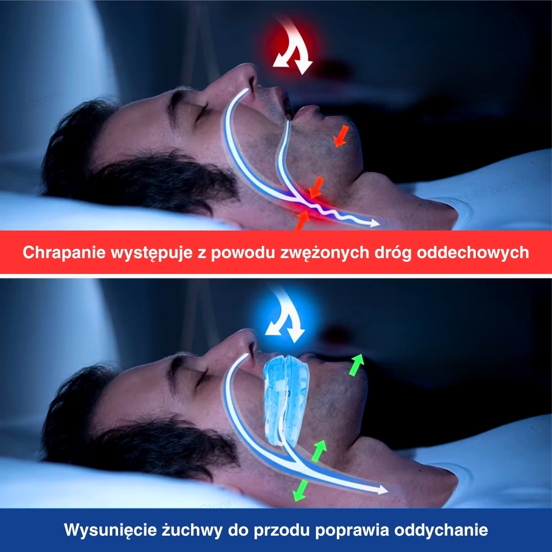 Person comfortably using the adjustable anti-snoring mouth guard for a quiet, restful night's sleep.