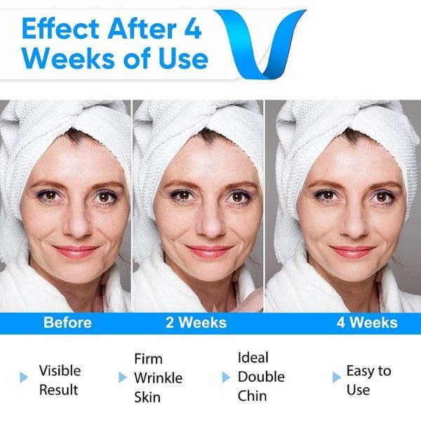 Double chin remover device, V-Face massager with blue light therapy for skin tightening.