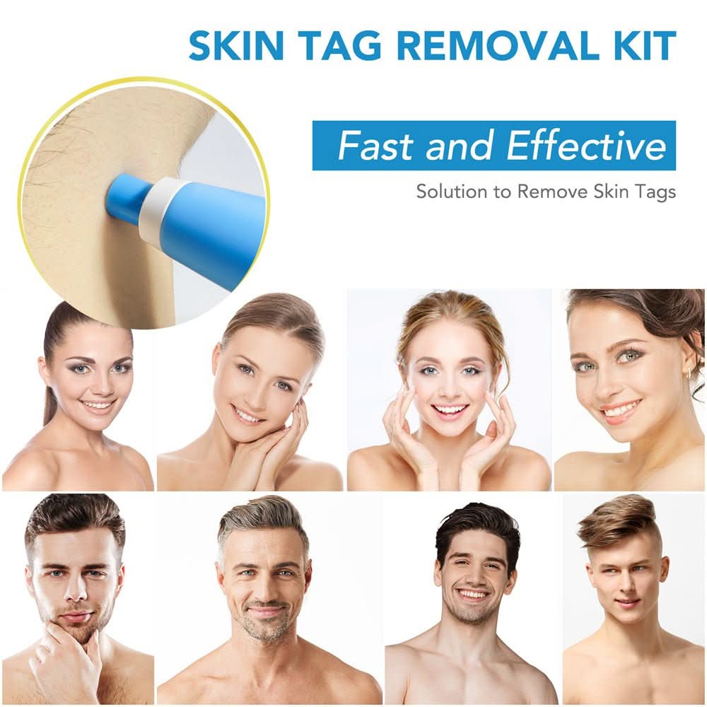 Packaging of a comprehensive Skin Tag & Wart Remover Kit for easy, at-home blemish elimination & clear skin.