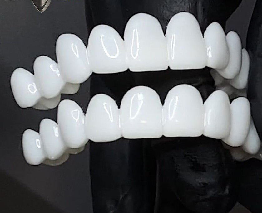Set of instant smile enhancement snap-on veneers, ready for perfect teeth.